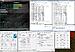 Click image for larger version. 

Name:	190x20-1520-Pi-1A.jpg 
Views:	1895 
Size:	188.9 KB 
ID:	89422